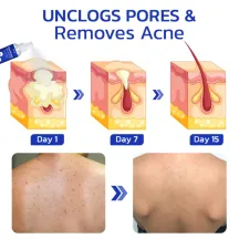 Ximonth Pore Care Skin Care Spray