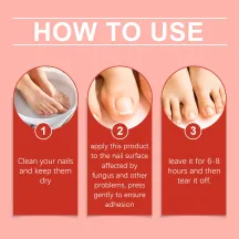 Ximonth Fungal Nail Patches