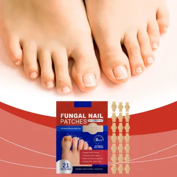 Ximonth Fungal Nail Patches