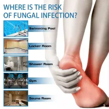 Ximonth Athlete's Foot Relief Spray
