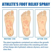 Ximonth Athlete's Foot Relief Spray