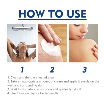 Ximonth Mole Remover Ointment