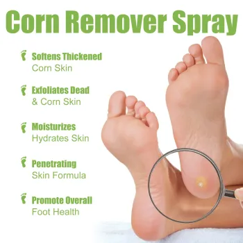 Ximonth Corn Remover Spray