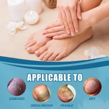 Ximonth Nails Essence Liquid