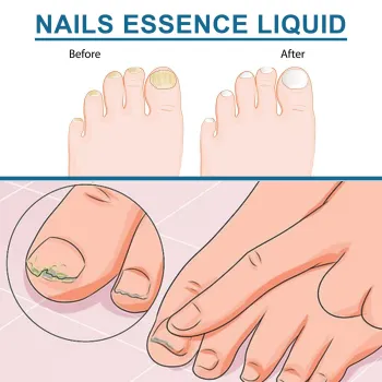 Ximonth Nails Essence Liquid