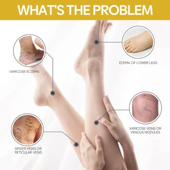 Ximonth Bee Venom Skin Smoothing Cream