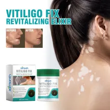 Ximonth Vitiligo Fix Revitalizing Elixir