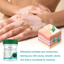 Ximonth Vitiligo Fix Revitalizing Elixir