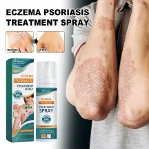 Ximonth Eczema Psoriasis Treatment Spray