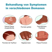Ximonth Eczema Psoriasis Treatment Spray