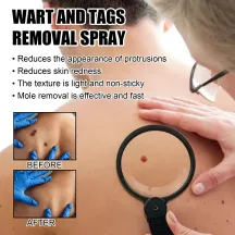 Ximonth Bee Venom Wart and Tags Removal Spray Ximonth Bee Venom Wart and Tags Removal Spray