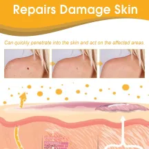 Ximonth Tag Recede Bee Venom Repair Spray