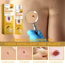 Ximonth Tag Recede Bee Venom Repair Spray