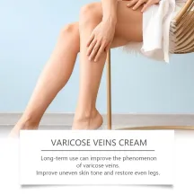 Ximonth Varicose Veins Cream