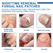 Ximonth Fungal Nail Patches Night Time Renewal