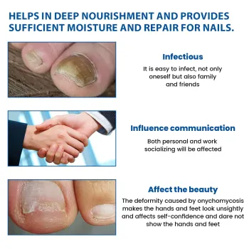 Ximonth Fungal Nail Patches Night Time Renewal