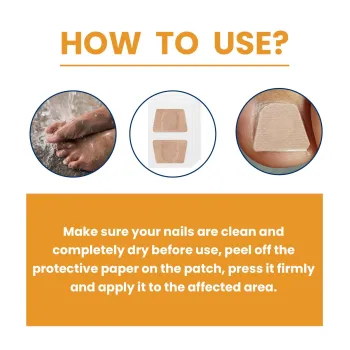 Ximonth Fungal Nail Patches 