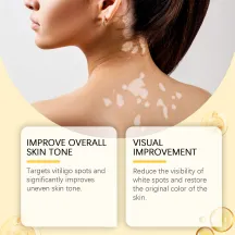 Ximonth Bee Venom Care Cream
